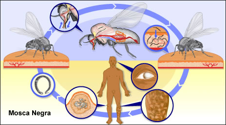 Las moscas negras al chupar sangre tienen un propósito, la ceguera en seres humanos